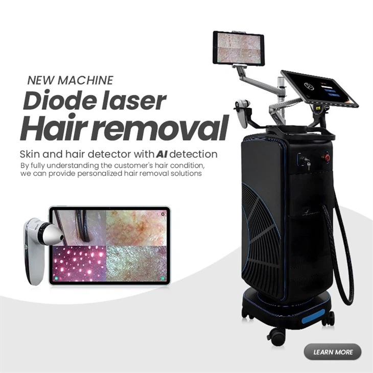 European Hot Selling Laser Hair Removal Machine