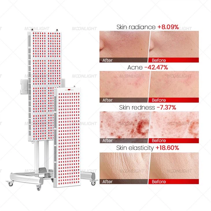 Red Light Therapy Panel